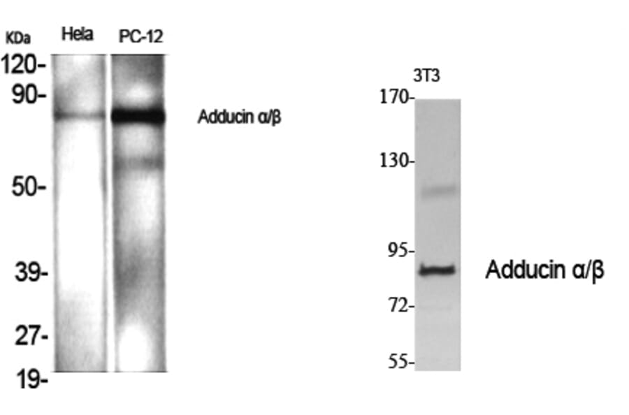 Western blot - Adducin α/β Polyclonal Antibody from Signalway Antibody (40554) - Antibodies.com