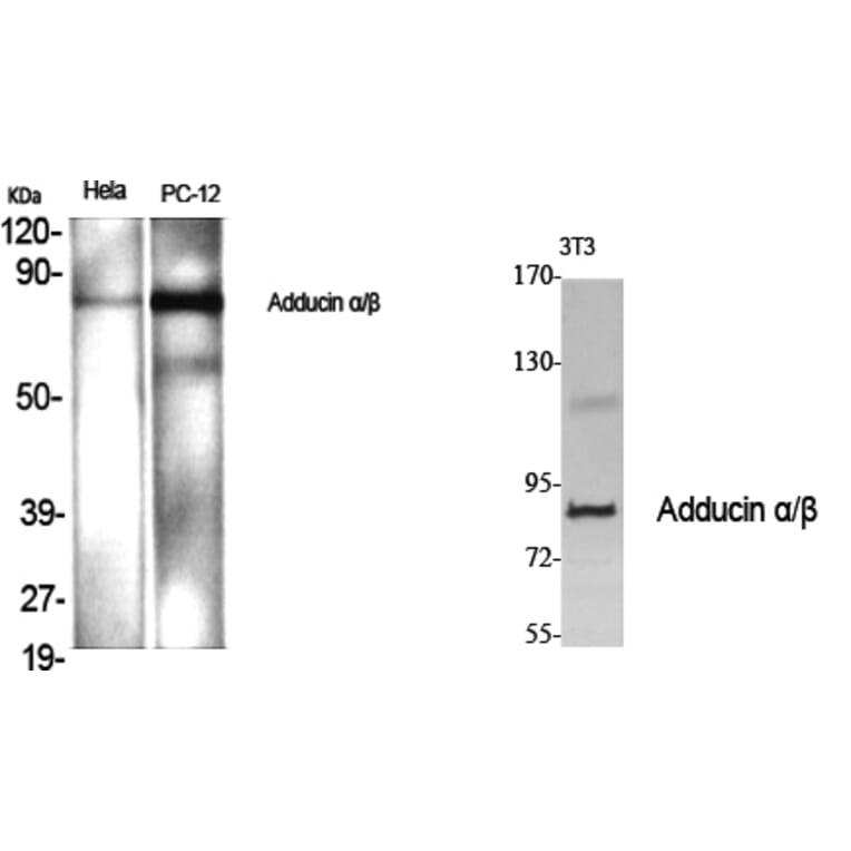 Western blot - Adducin α/β Polyclonal Antibody from Signalway Antibody (40554) - Antibodies.com