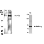Western blot - Adducin α/β Polyclonal Antibody from Signalway Antibody (40554) - Antibodies.com