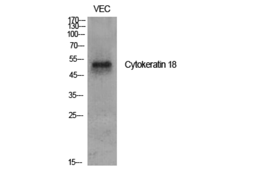 Western blot - Cytokeratin 18 Polyclonal Antibody from Signalway Antibody (40823) - Antibodies.com