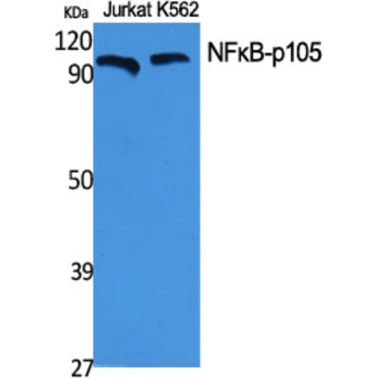 Western blot - NFκB-p105 Polyclonal Antibody from Signalway Antibody (41225) - Antibodies.com