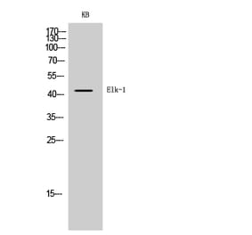 Western blot - Elk-1 Polyclonal Antibody from Signalway Antibody (40876) - Antibodies.com