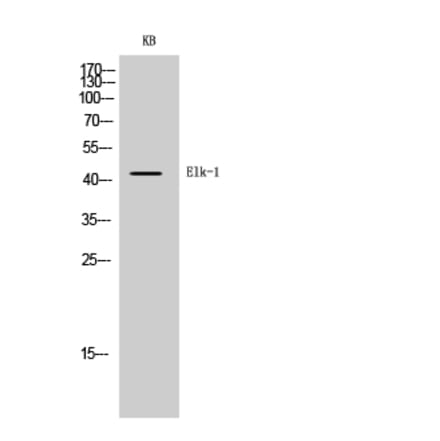 Western blot - Elk-1 Polyclonal Antibody from Signalway Antibody (40876) - Antibodies.com