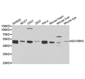 Western blot - SUV39H2 Antibody from Signalway Antibody (33093) - Antibodies.com