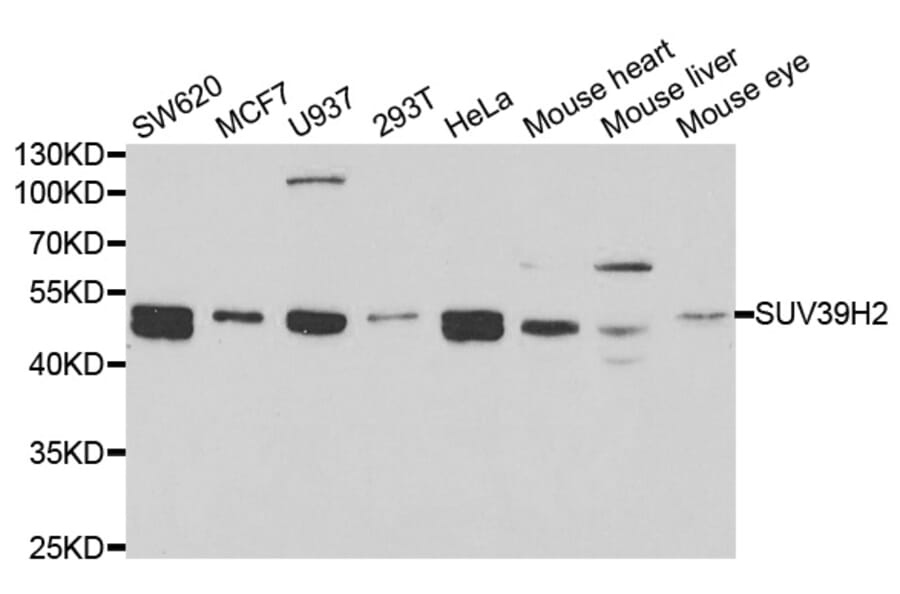 Western blot - SUV39H2 Antibody from Signalway Antibody (33093) - Antibodies.com