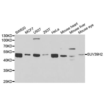 Western blot - SUV39H2 Antibody from Signalway Antibody (33093) - Antibodies.com
