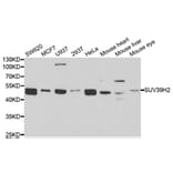 Western blot - SUV39H2 Antibody from Signalway Antibody (33093) - Antibodies.com