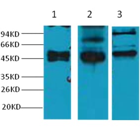 Western blot - CK17 Mouse Monoclonal Antibody from Signalway Antibody (38038) - Antibodies.com