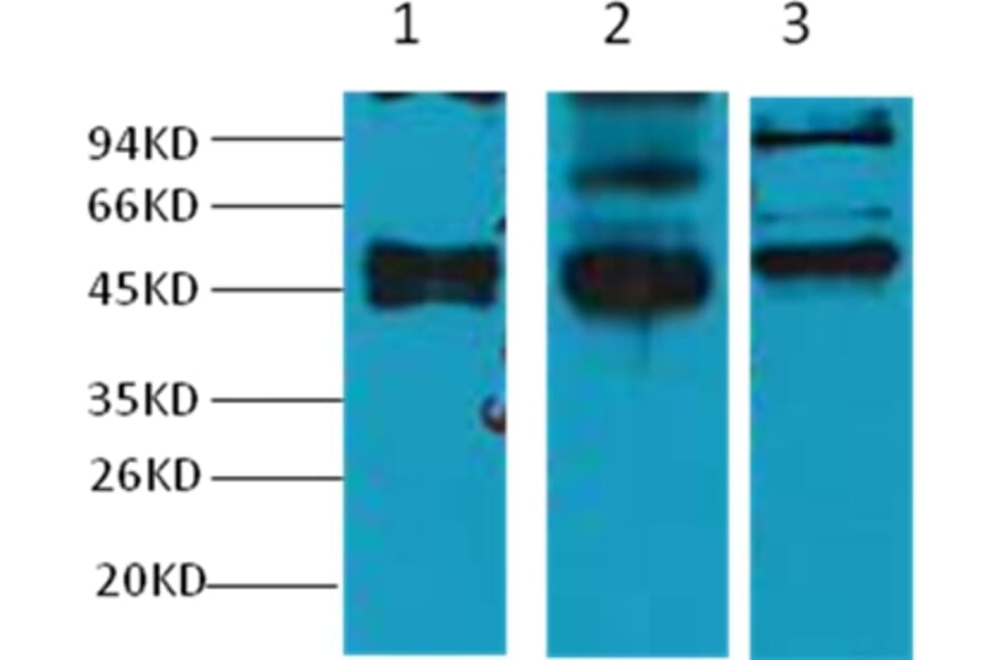 Western blot - CK17 Mouse Monoclonal Antibody from Signalway Antibody (38038) - Antibodies.com