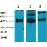 Western blot - CK17 Mouse Monoclonal Antibody from Signalway Antibody (38038) - Antibodies.com