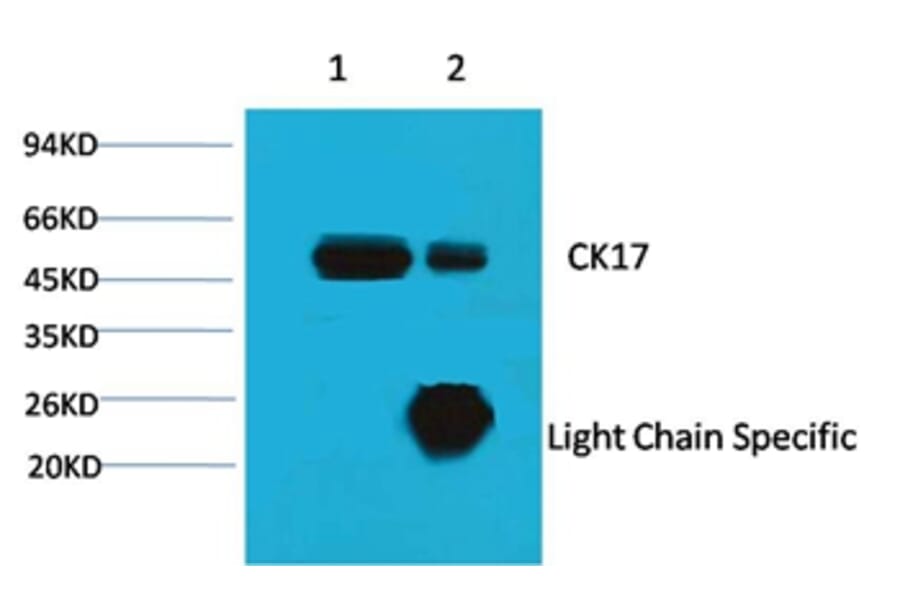 CK17 Mouse Monoclonal Antibody from Signalway Antibody (38038) - Antibodies.com