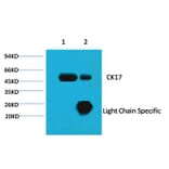 CK17 Mouse Monoclonal Antibody from Signalway Antibody (38038) - Antibodies.com