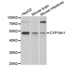 Western blot - CYP19A1 Antibody from Signalway Antibody (32631) - Antibodies.com