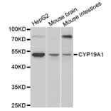 Western blot - CYP19A1 Antibody from Signalway Antibody (32631) - Antibodies.com