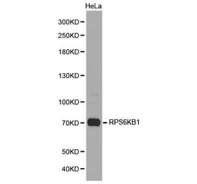 Western blot - RPS6KB1 Antibody from Signalway Antibody (32654) - Antibodies.com