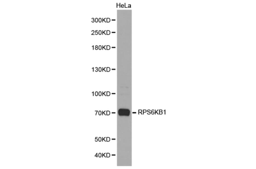 Western blot - RPS6KB1 Antibody from Signalway Antibody (32654) - Antibodies.com