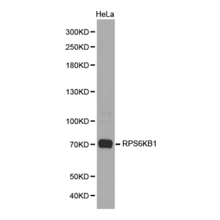 Western blot - RPS6KB1 Antibody from Signalway Antibody (32654) - Antibodies.com