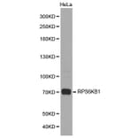 Western blot - RPS6KB1 Antibody from Signalway Antibody (32654) - Antibodies.com