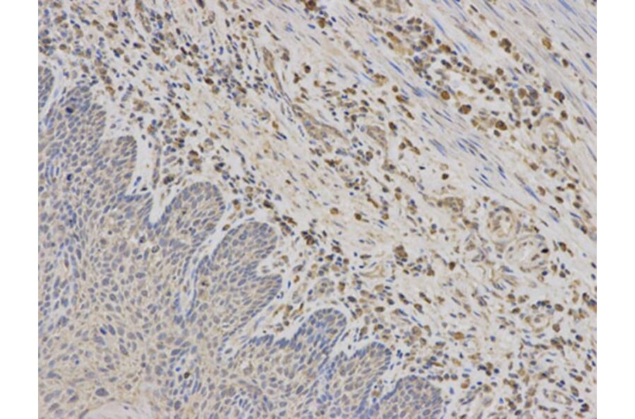 Immunohistochemistry - RPS6KB1 Antibody from Signalway Antibody (32654) - Antibodies.com