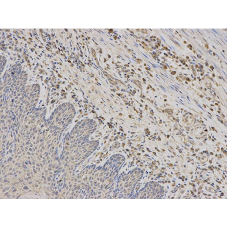 Immunohistochemistry - RPS6KB1 Antibody from Signalway Antibody (32654) - Antibodies.com