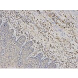 Immunohistochemistry - RPS6KB1 Antibody from Signalway Antibody (32654) - Antibodies.com