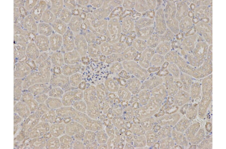 Immunohistochemistry - RPS6KB1 Antibody from Signalway Antibody (32654) - Antibodies.com