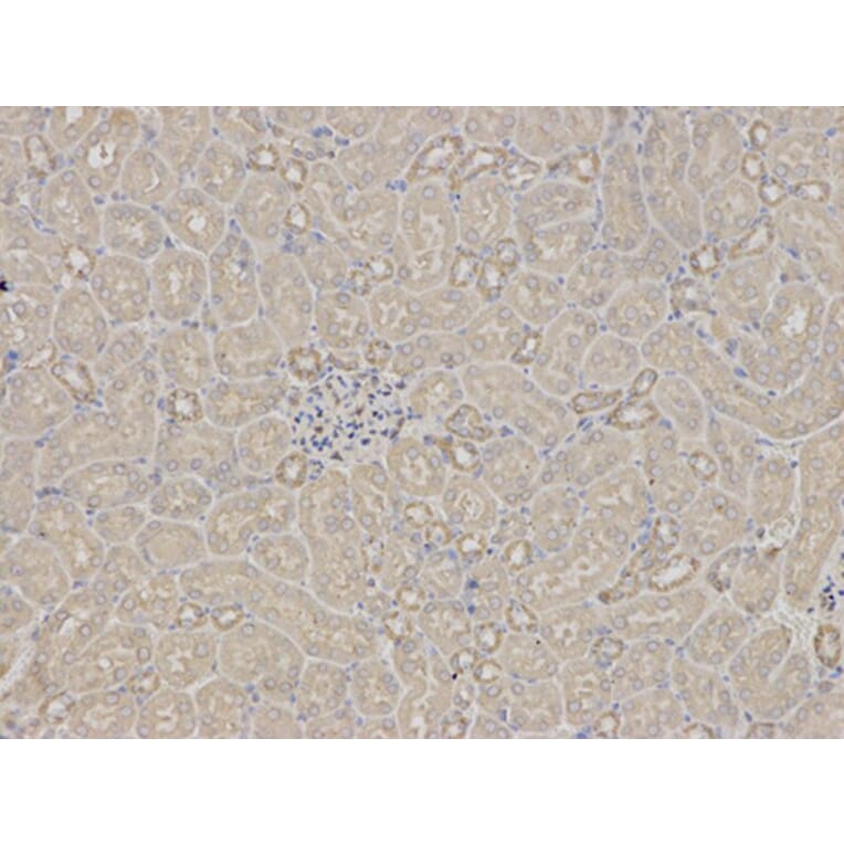 Immunohistochemistry - RPS6KB1 Antibody from Signalway Antibody (32654) - Antibodies.com