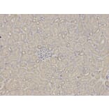 Immunohistochemistry - RPS6KB1 Antibody from Signalway Antibody (32654) - Antibodies.com