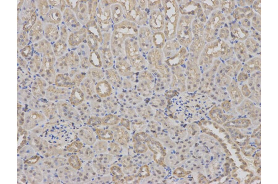 Immunohistochemistry - RPS6KB1 Antibody from Signalway Antibody (32654) - Antibodies.com