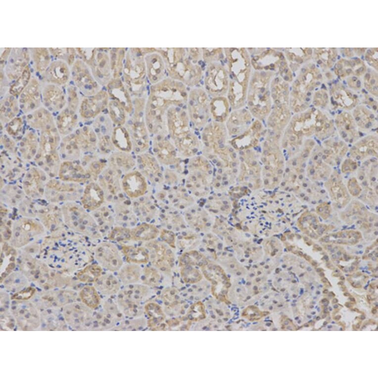 Immunohistochemistry - RPS6KB1 Antibody from Signalway Antibody (32654) - Antibodies.com