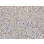 Immunohistochemistry - RPS6KB1 Antibody from Signalway Antibody (32654) - Antibodies.com