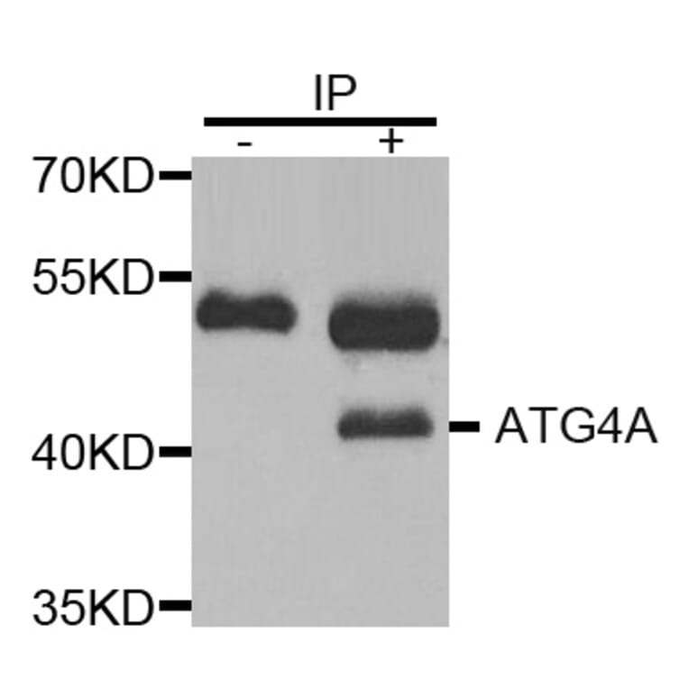 Immunoprecipitation - ATG4A Antibody from Signalway Antibody (32744) - Antibodies.com