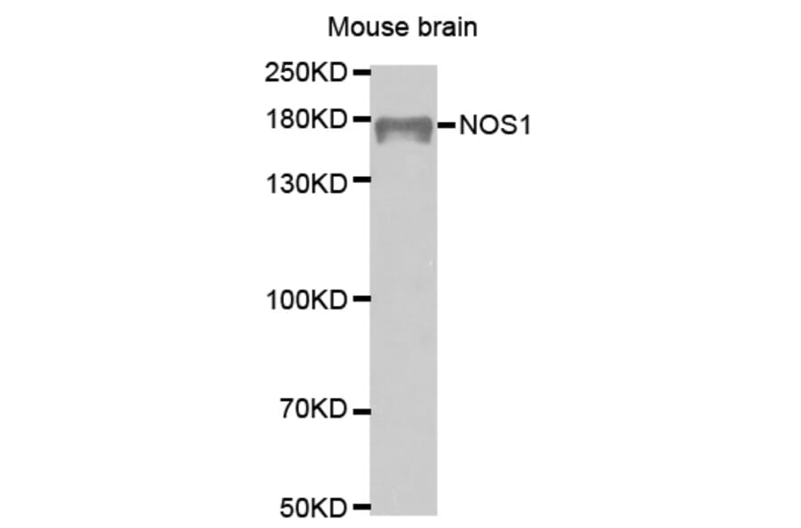Western blot - NOS1 Antibody from Signalway Antibody (32287) - Antibodies.com