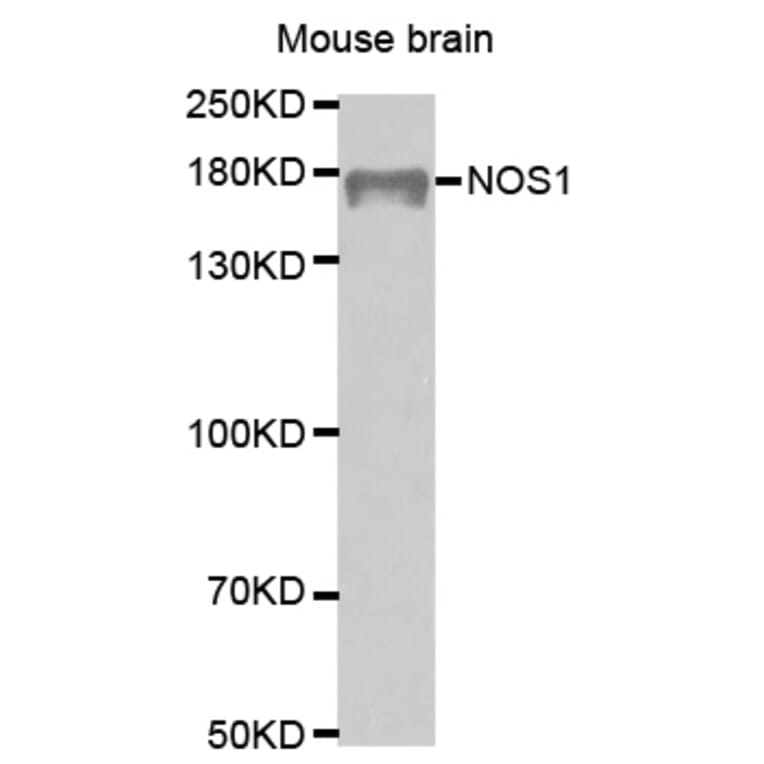 Western blot - NOS1 Antibody from Signalway Antibody (32287) - Antibodies.com