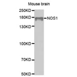 Western blot - NOS1 Antibody from Signalway Antibody (32287) - Antibodies.com