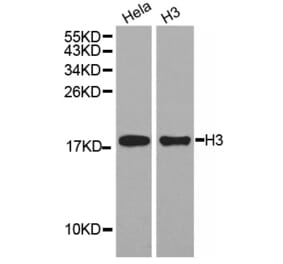 Western blot - Histone H3 Antibody from Signalway Antibody (32667) - Antibodies.com