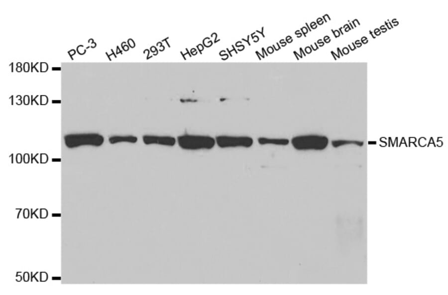 Western blot - SMARCA5 Antibody from Signalway Antibody (32545) - Antibodies.com