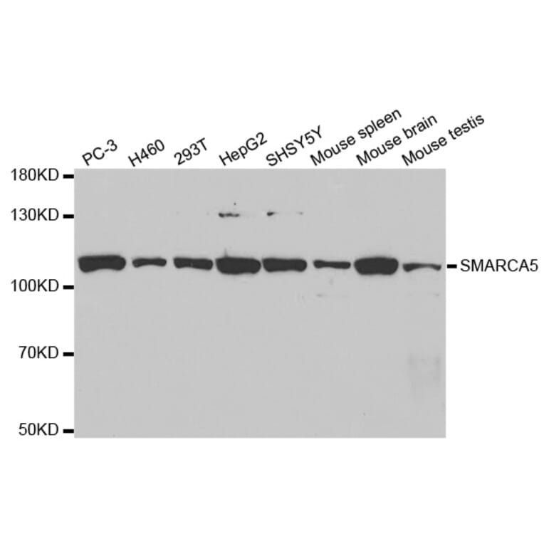 Western blot - SMARCA5 Antibody from Signalway Antibody (32545) - Antibodies.com