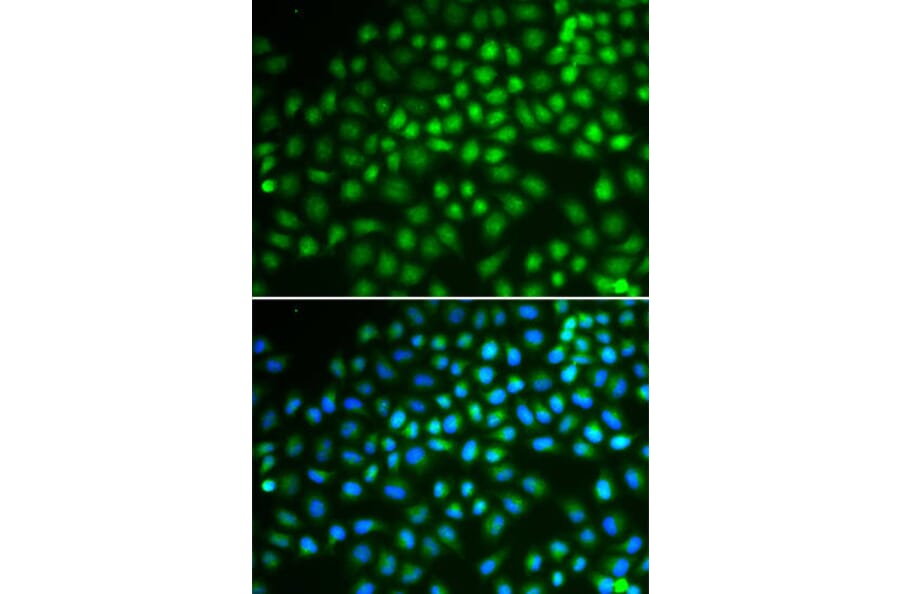 Immunofluorescence - SMARCA5 Antibody from Signalway Antibody (32545) - Antibodies.com