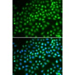 Immunofluorescence - SMARCA5 Antibody from Signalway Antibody (32545) - Antibodies.com