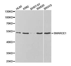 Western blot - SMARCE1 Antibody from Signalway Antibody (32801) - Antibodies.com