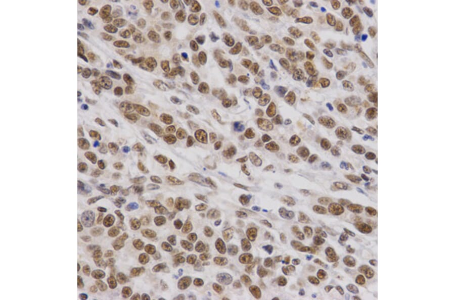 Immunohistochemistry - SMARCE1 Antibody from Signalway Antibody (32801) - Antibodies.com