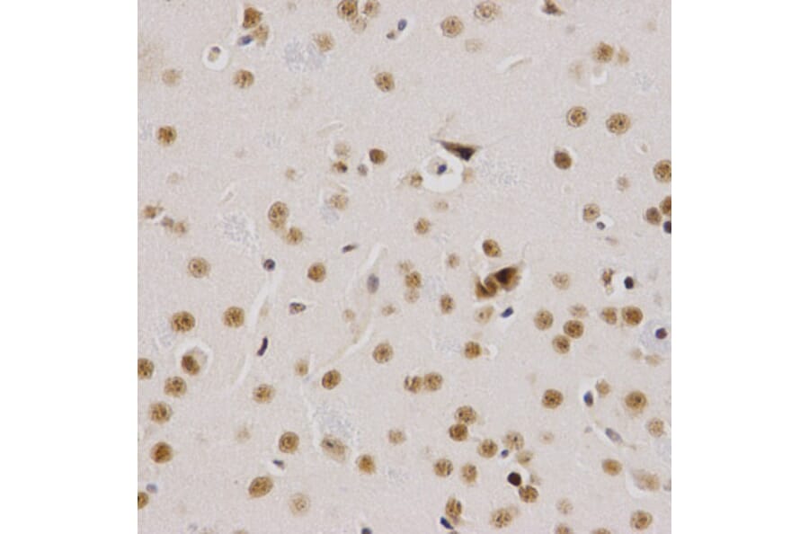 Immunohistochemistry - SMARCE1 Antibody from Signalway Antibody (32801) - Antibodies.com