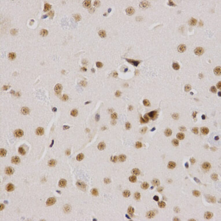 Immunohistochemistry - SMARCE1 Antibody from Signalway Antibody (32801) - Antibodies.com