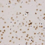 Immunohistochemistry - SMARCE1 Antibody from Signalway Antibody (32801) - Antibodies.com