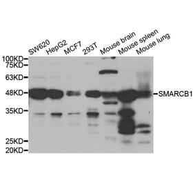 Western blot - SMARCB1 Antibody from Signalway Antibody (33029) - Antibodies.com