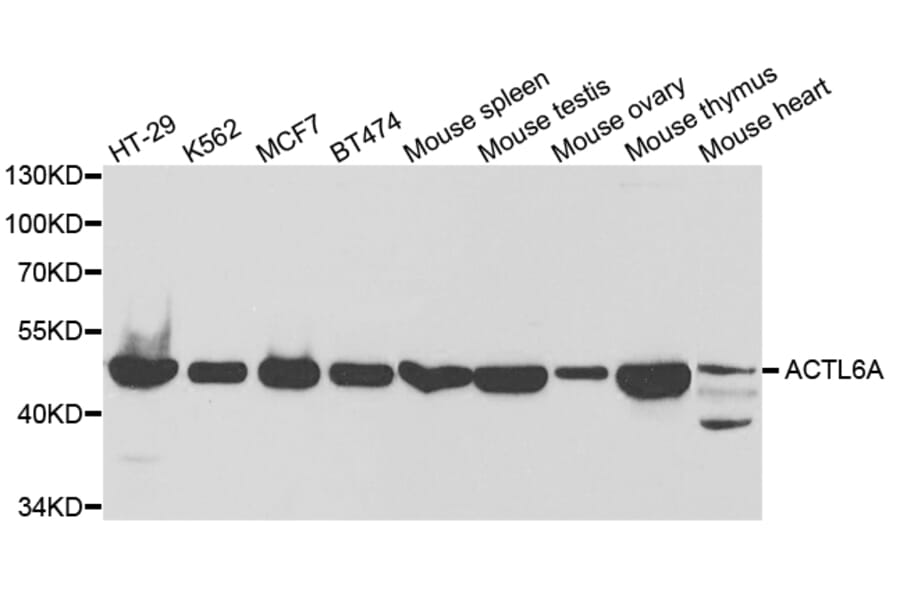 Western blot - ACTL6A Antibody from Signalway Antibody (32821) - Antibodies.com