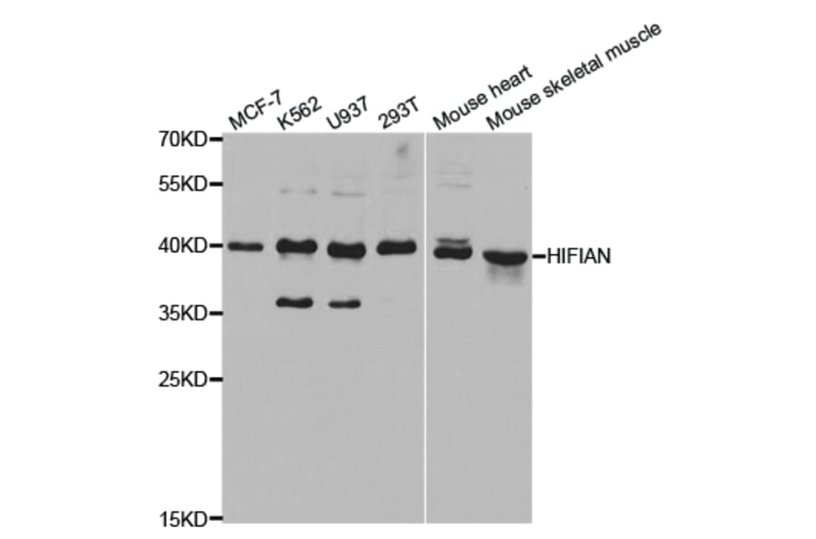 Western blot - HIF1AN Antibody from Signalway Antibody (32866) - Antibodies.com