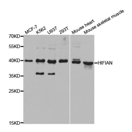 Western blot - HIF1AN Antibody from Signalway Antibody (32866) - Antibodies.com