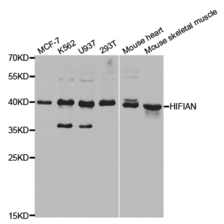 Western blot - HIF1AN Antibody from Signalway Antibody (32866) - Antibodies.com